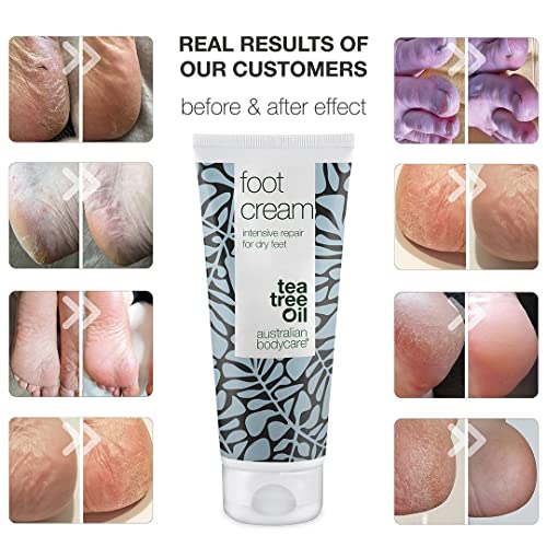 Foot Cream de Australian Bodycare, 100 ml | Removedor de durezas para hombres y mujeres | Hidratante para pies muy secos y agrietados, con 10% de urea | Con aceite de árbol del té australiano