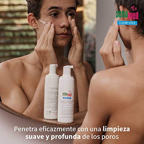 Sebamed Clear Face Tónico Facial – 150ml Para piel grasa y con imperfecciones o tendencia acneica - ayuda a combatir las impurezas cutáneas de forma eﬁcaz, Pantenol y Hamamelis, calma la irritación