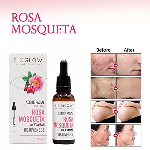 SET Sérum Facial Rosa Mosqueta Vegano Hidratante Anti edad con Vitamina E Antiarrugas Anti manchas Regenera la piel elimina Cicatrices de Acné y Estrías + Aloe Vera Gel Post Depilación Puro