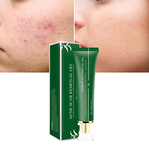 SouiWuzi Acne Scar ScRoval Gel Cara Marcas Cuerpo Cuerpo Reparación Cake Crema Tratamiento de acné Esencia 30 g para el accesario de Belleza