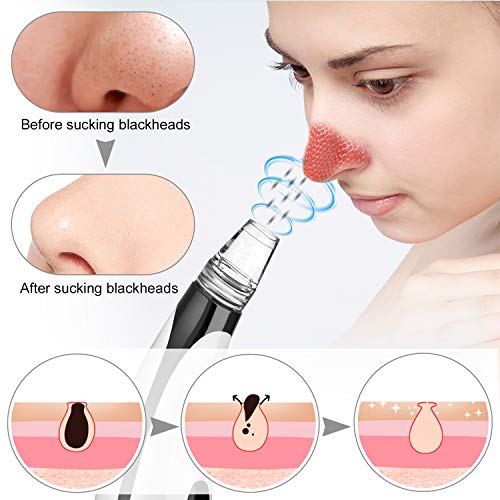 RaMoKey Limpiador De Poros Eliminador de Espinillas Succionador de Puntos Negros y Espinillas Puntos Negros Limpiador, limpiador facial USB Blackhead Remover con 6 Pulidores Faciales