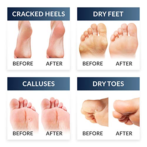 Exfoliante pies quita callos pies calcetines exfoliantes de pies mascarilla pies peeling babyfoot baby foot elimina callos, 1 pare (hasta la talla 47)