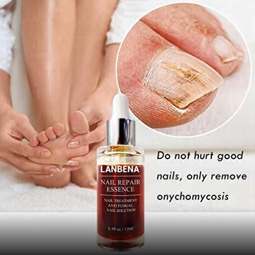 FOY LANBENA Nail Repair Essence Serum Fungus Treatment Remoción Uñas Onicomicosis Transparente