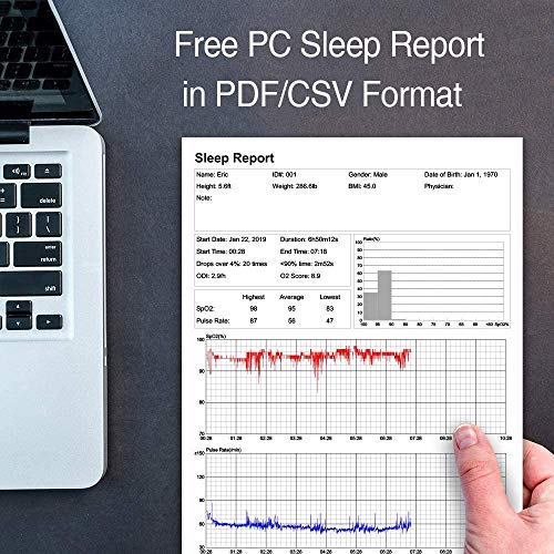 O2 Ring Pulsioxímetro, Oxygen Monitor Bluetooth, Medición de la saturación de oxígeno (SpO₂), Frecuencia Cardíaca (pulso), con Alarma, APP para Android e iOS, Reporte de PC