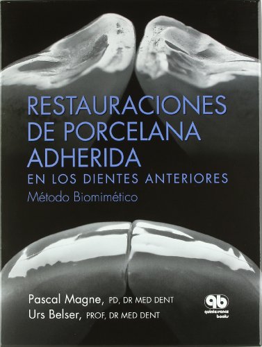 RESTAURACIONES DE PORCELANA ADHERIDA EN LOS DIENTES ANTERIORES, METODO BIOMIMETICO (LIBRO CON ESTUCH