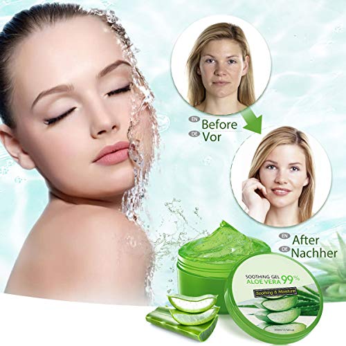 Skymore Aloe Vera Gel- Humectante Facial, Hidratante Gel de Aceite para el Control del Acné Corporales Y Quemaduras Solares