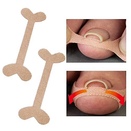 Corrector de Uñas de Los Pies,Parche de Corrección de Uñas de los Pies,Pegatinas de Uñas Encarnadas Corrección Pegatina Cuidado De Los Pies de Las Sin Pegamento para Hombres Mujeres 10PCS