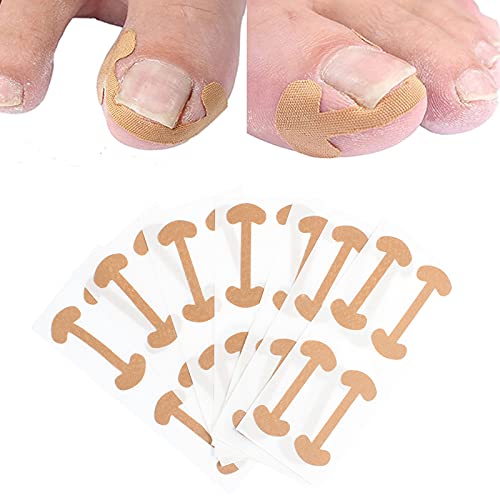 Corrector de Uñas de Los Pies,Parche de Corrección de Uñas de los Pies,Pegatinas de Uñas Encarnadas Corrección Pegatina Cuidado De Los Pies de Las Sin Pegamento para Hombres Mujeres 10PCS