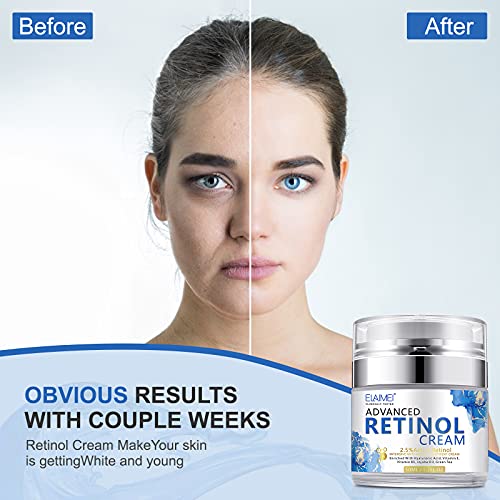 Crema De Retinol, Crema Facial De Día y Noche, Crema Antienvejecimiento, Crema Hidratante Con Retinol Para Rostro y Cuello, Crema Antiarrugas Activa Con 2,5 % De Retinol Para Mujeres y Hombres