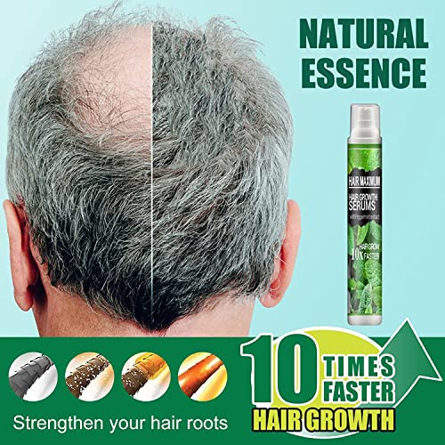 Herbalrevive Hair-growth Essence Spray, Hairrebirth Herbal Spray, Herbal Hair-growth Essence Spray, Hair Volumizer Texture Spray, Send Massage Comb (3pcs)