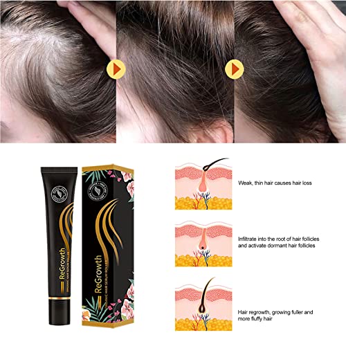 LMNH Organic Hair Serum Roller, Regrowth Organic Hair Serum Roller Set, Triple Roll-On Massager Hair Growth Essence, Biotin Hair Growth Serum (4PCS)