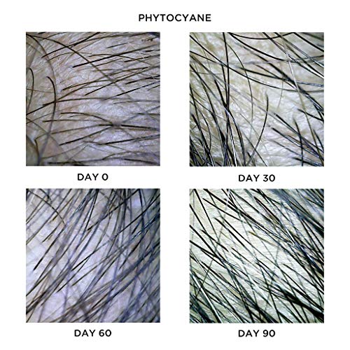 Phyto Tratamiento de fitociano para el cabello fino, 12 x 7,5 ml