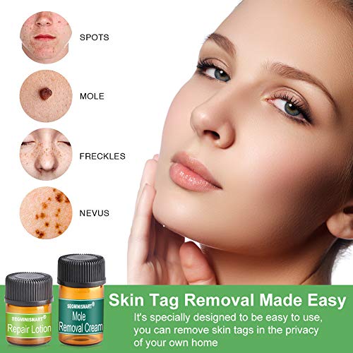 Skin Tag Remover, Mole Removal,Manchas Cara Eliminación,Liquid Natural Painless Mole Remover, Eliminación Manchita la Edad, Esputo, Pecas