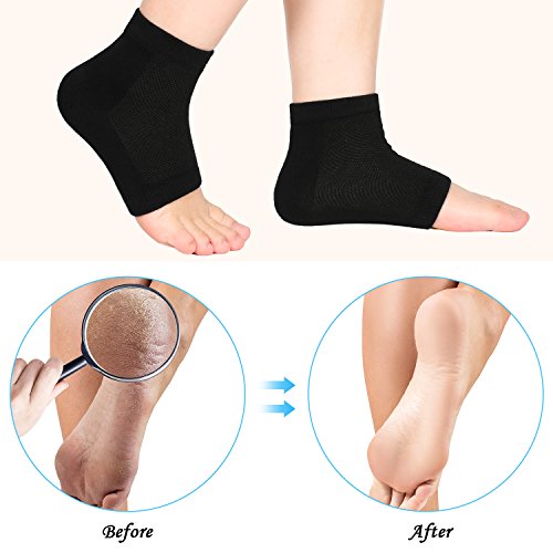 3 Pares de Calcetines de Talón de Gel Suave de Ventilación Calcetines sin Dedos para Piel Agrietada Seca Cuidado de Piel Hidratante de Día y Noche (Negro, Talla Regular)  