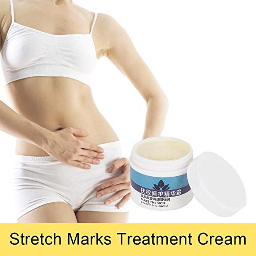 Crema Reafirmante 50g Crema Reparadora de Estrías Crema Corporal Antiestrías para Eliminar las Líneas de Grasa Reparación de Maternidad