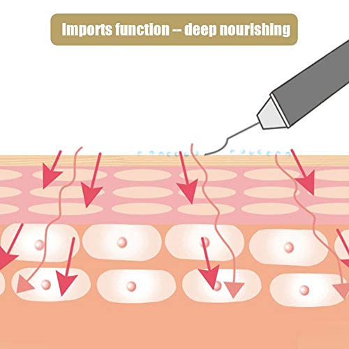 Depurador de piel, ultrasónico Dispositivo de Limpieza para la piel espátula para eliminar espinillas extractor de comedones limpiador de poros faciales para exfoliación y reafirmación(blanco)