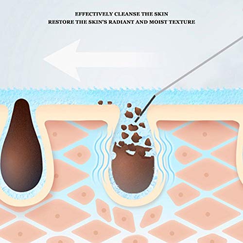 Depurador de piel, ultrasónico Dispositivo de Limpieza para la piel espátula para eliminar espinillas extractor de comedones limpiador de poros faciales para exfoliación y reafirmación(blanco)