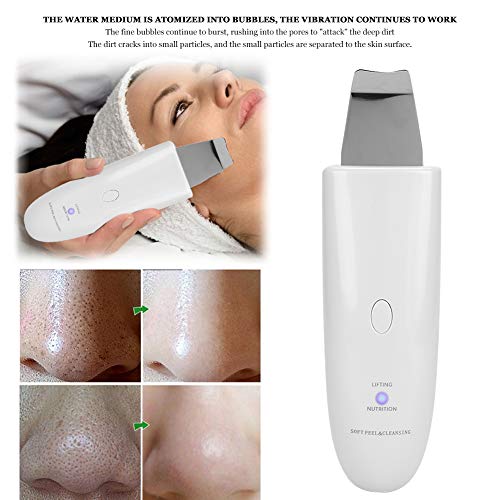 Depurador de piel, ultrasónico Dispositivo de Limpieza para la piel espátula para eliminar espinillas extractor de comedones limpiador de poros faciales para exfoliación y reafirmación(blanco)