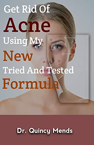 Get Rid of Acne Using My New Tried And Tested Formula (English Edition)