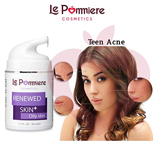 Le Pommiere Tratamiento Acné gel 50ml. Ayuda a remover espinillas, granos en cara o cuerpo. Anti imperfecciones facial y corporal. Adolescente, juvenil, hormonal o quístico