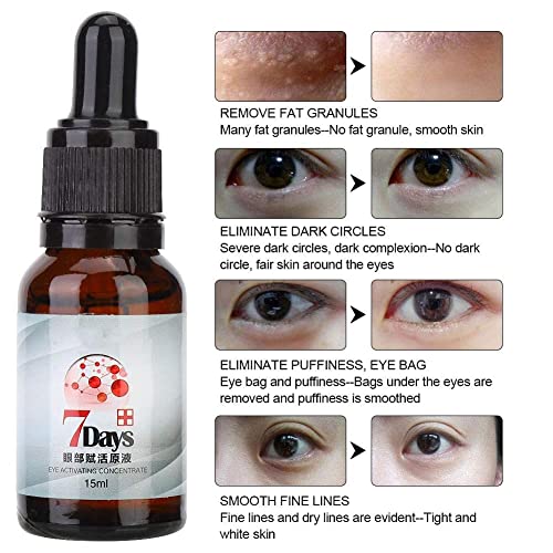 Suero de ojos - Suero de ojos para ojeras, hinchazón de ojos, tratamiento de bolsas de ojos, suero de ojos hidratante antiarrugas para hombres o mujeres, 15 ml