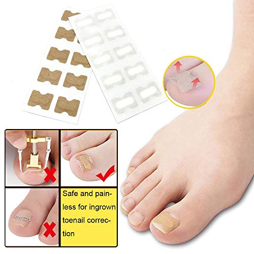 40 Pcs Parche de Uñas Sin Pegamento Pegatinas Correctoras de Uñas Encarnadas Pegatinas para el Cuidado de Los Pies Etiqueta de CorreccióN de Las UñAs de Los Pies Sin Pegamento para Hombres Mujeres