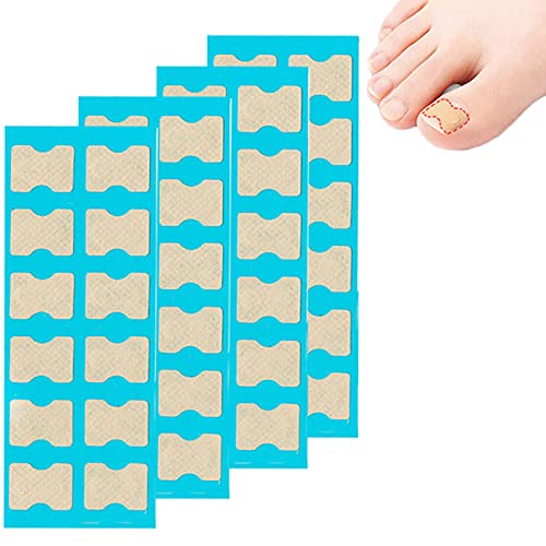 48 Piezas Parche Corrector de Uñas de Los Pies Pegatinas de Corrección de Uñas Encarnadas Parche Elástico de Uña Del Pie Correctoras Uñas Encarnadas para Mujeres y Hombres, para Cuidado de Las Uñas