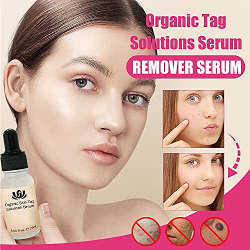 IPQYIHF Organic Skin Spot Solution, Organic Skin Spot Purifying Serum, Skin Tag Removal Cream, Face Serum for Women, All Natural Mole Removal, Fast & Effective (3 PCS)