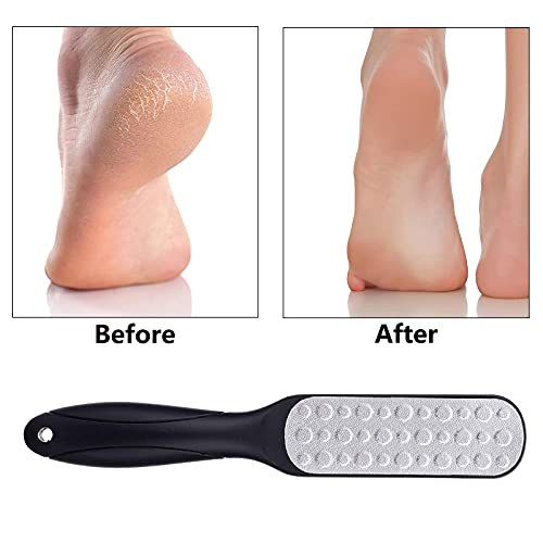 Pie De Lima Manual Removedor De Lima De Pies Mano Removedor De Callos De Pedicura Lima Para Pies Con Mango ErgonóMico Para Pedicura Y Cuidado De Los Pies,Acero Inoxidable De Doble Cara,1 Pieza,Negro