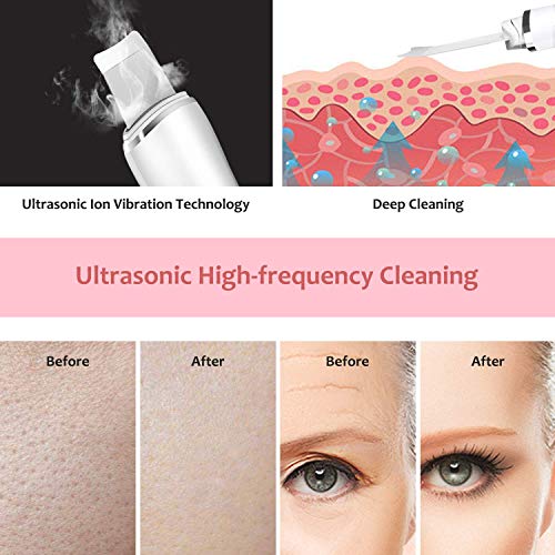 Espatula Ultrasonic Dispositivo, AUKUYEE Ultrasónico de Limpieza de la piel Facial,Depurador de piel facial portátil para Peeling facial poros Limpiador de la piel Dispositivo de belleza para el hogar