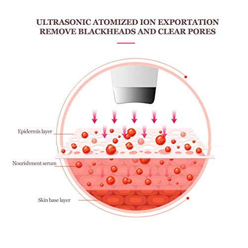 Exfoliante ultrasónico USB, pala ultrasónica profesional para espinillas, limpiador eléctrico de poros, depurador de piel para eliminar espinillas, limpiador facial para rejuvenecimiento de la piel