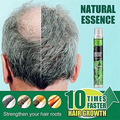 Herbal Hair Growth Essence Spray - Anti Hair Loss Fast Grow Prevent Hair Dry,Natural Herbal Rapid Hair Growth Serum,Prevent Postpartum Hair Loss Hairlines Herbal Hair Essence Spray (5pcs)