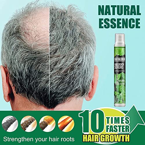 QAZX HairReBirth Herbal Spray, Natural Herbal Hair Growth Essence Spray, HerbalRevive Hair-Growth Essence Spray, Herbal Hair Growth Maximizer Spray for Men and Women Anti Hair Loss Fast Grow (3PCS)