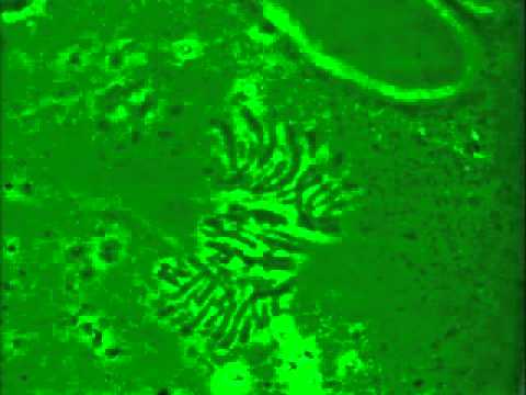 Las fases de la mitosis observadas bajo el microscopio