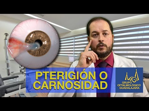 La carnosidad gelatina transparente en el ojo: causas y tratamientos en 2024