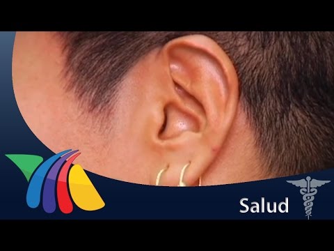 ¿Qué significa el pitido en el oído derecho y cómo afecta a nuestra audición?