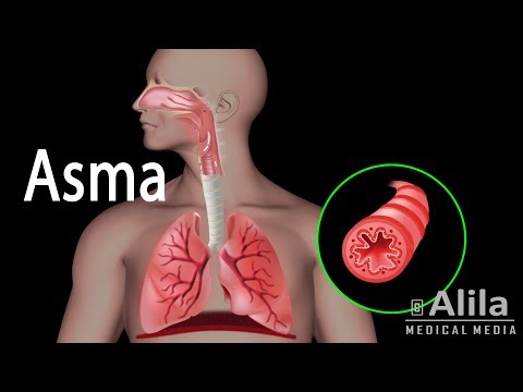 El asma en altitudes elevadas: causas y cómo manejarlo