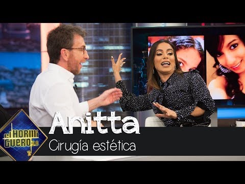 Susana Bicho revela las cirugías estéticas a las que se ha sometido