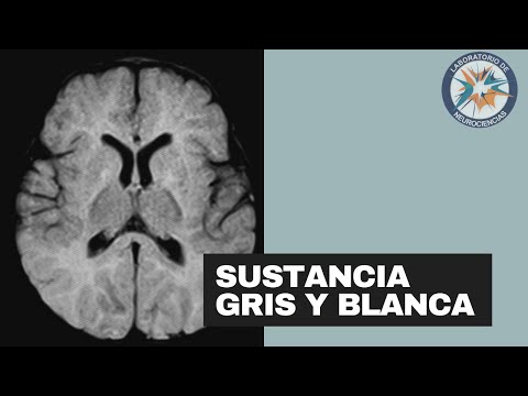 Anatomía cerebral: Comprendiendo la diferencia entre sustancia blanca y sustancia gris