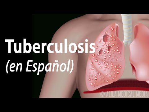 Las enfermedades que pueden confundirse con la tuberculosis