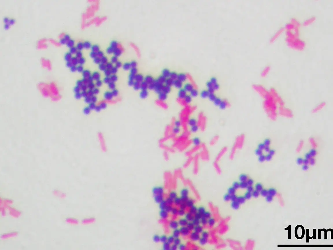 Tinción de Gram de Mycobacterium tuberculosis: Características y aplicaciones.